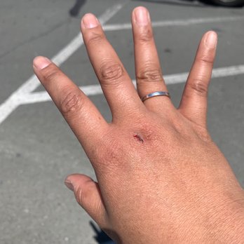 The Home Depot - Scrape on my hand. - Nurseries & Gardening Near Me - El Cerrito, California The Home Depot - Scrape on my hand. - Nurseries & Gardening Near Me - El Cerrito, California