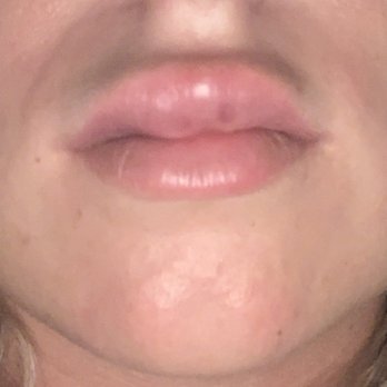 CNY Cosmetic & Reconstructive Surgery - Skin Care Near Me - East Syracuse, New York CNY Cosmetic & Reconstructive Surgery - Skin Care Near Me - East Syracuse, New York