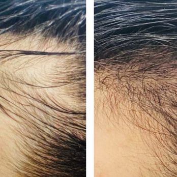 Vantis Institute - Hair Loss Centers Near Me - Newport Beach, California Vantis Institute - Hair Loss Centers Near Me - Newport Beach, California