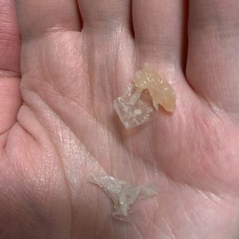 Delicious Dim Sum - Plastic in food - Dim Sum Near Me - San Francisco, California