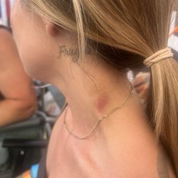 Sparadise Massage & Wellness Center - Bruise from massage therapist Jack. I asked him three times to use less pressure but he still bruised me