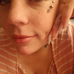 Ignore my dry skin Ignore my dry skin