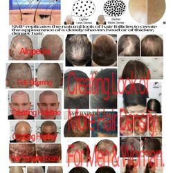 nYou Image Ink - What is Scalp Micropigmentation (SMP)