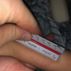 First Academy Child Care - Bite mark found on my childs arm after I picked him up. No incident report and no one knows what happened. Now he says "teacher bite my arm"
