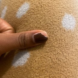 My thumb later in the day missing half a nail. My thumb later in the day missing half a nail.