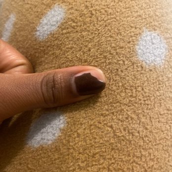 Uptown Nails - My thumb later in the day missing half a nail. - Nail Salons Near Me - Mebane, North Carolina Uptown Nails - My thumb later in the day missing half a nail. - Nail Salons Near Me - Mebane, North Carolina