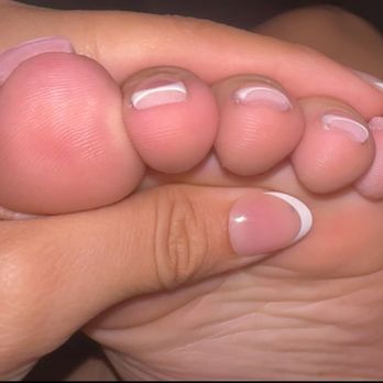 Grand Nail Spa - This is even after trying to file the acrylic under my toe. - Nail Salons Near Me - Dallas, Texas