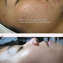 Della Bella Acne & Skin Care Center