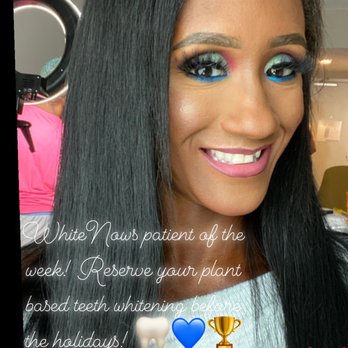WhiteNow - Patient of the week! - Teeth Whitening Near Me - Dallas, Texas WhiteNow - Patient of the week! - Teeth Whitening Near Me - Dallas, Texas