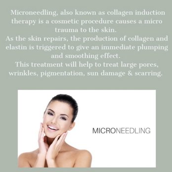 U Glow Gurl - Microneedling available - Skin Care Near Me - Glendale, Arizona U Glow Gurl - Microneedling available - Skin Care Near Me - Glendale, Arizona