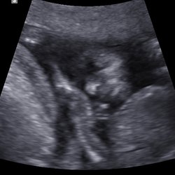 Home Baby Reveal - 2D - Baby's Face