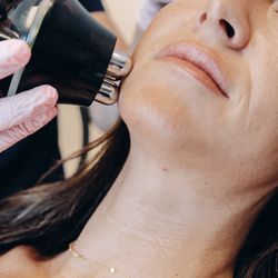 Grey Aesthetics - Non Surgical FaceLift