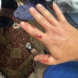 CareNow Urgent Care - West Jordan - Injury