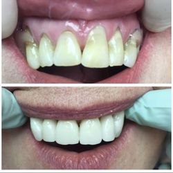 Indiana Emergency Dental