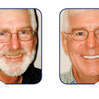 Nusblatt Dental - Another happy Lumineers patient! - General Dentistry Near Me - New York, New York Nusblatt Dental - Another happy Lumineers patient! - General Dentistry Near Me - New York, New York