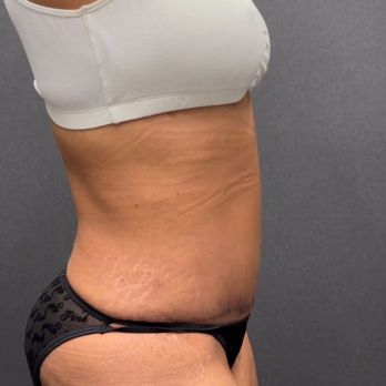 Rady Rahban, MD - Cosmetic Surgeons Near Me - Beverly Hills, California Rady Rahban, MD - Cosmetic Surgeons Near Me - Beverly Hills, California