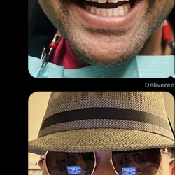 Tracy Orchard Dental Care - Before & After photos 4 crowns & 16 veneers - 20 total teeth repaired -