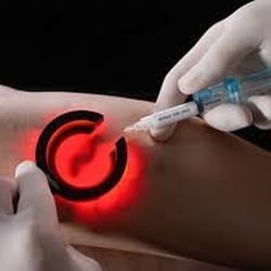 Aventura Vein Specialists