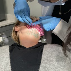 Omni Medspa - Smooth Threads for Chin Lift