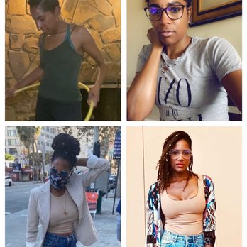 Aesthetic MdR - Left to Right Top Pictures: April 2020 and June 2020 Bottom Pictures: April 2021 (6 months post-op) and August 2021 (10 months post-op) - Medical Spas Near Me - Marina Del Rey, California