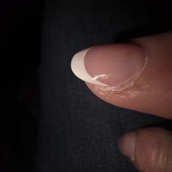 Lily's Nails - The acrylic on my cuticle and the rawness from filing