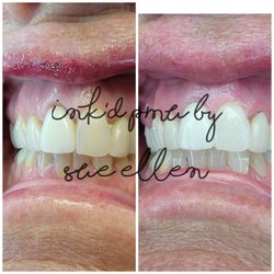 Ink'd PMU By Sue Ellen - Teeth whitening