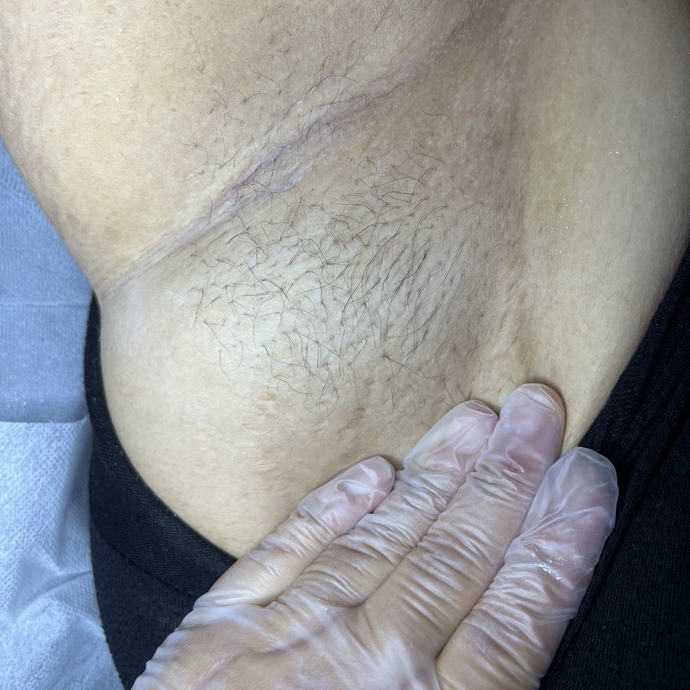 Elena G Beauty - Long underarm hair doesn't stand a chance with Elena! - Skin Care Near Me - El Segundo, California Elena G Beauty - Long underarm hair doesn't stand a chance with Elena! - Skin Care Near Me - El Segundo, California