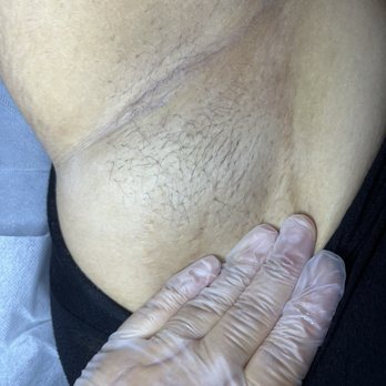 Elena G Beauty - Long underarm hair doesn't stand a chance with Elena! - Skin Care Near Me - El Segundo, California Elena G Beauty - Long underarm hair doesn't stand a chance with Elena! - Skin Care Near Me - El Segundo, California