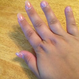 Two nails missing on this hand after 1.5 weeks Two nails missing on this hand after 1.5 weeks