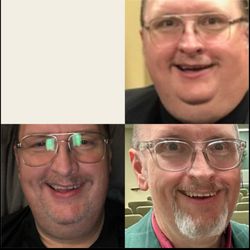 New Life Medical & Aesthetics - Me with my transformation
