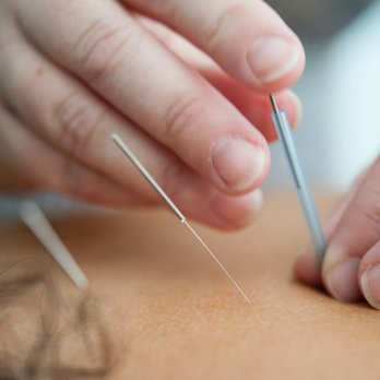 Guhn Holistic - Acupuncture Near Me - Brea, California Guhn Holistic - Acupuncture Near Me - Brea, California