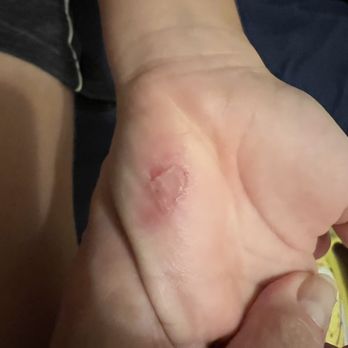Sky Zone Trampoline Park - Bite on hand - Trampoline Parks Near Me - Springfield, Illinois Sky Zone Trampoline Park - Bite on hand - Trampoline Parks Near Me - Springfield, Illinois