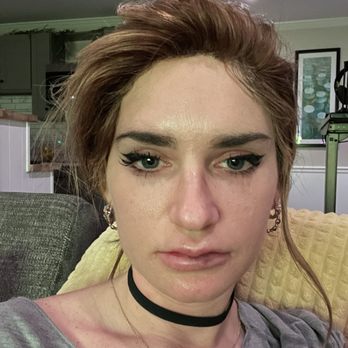 Kalos Facial Plastic Surgery - They are uneven on the bottom and a triangle on top - Plastic Surgeons Near Me - Atlanta, Georgia Kalos Facial Plastic Surgery - They are uneven on the bottom and a triangle on top - Plastic Surgeons Near Me - Atlanta, Georgia