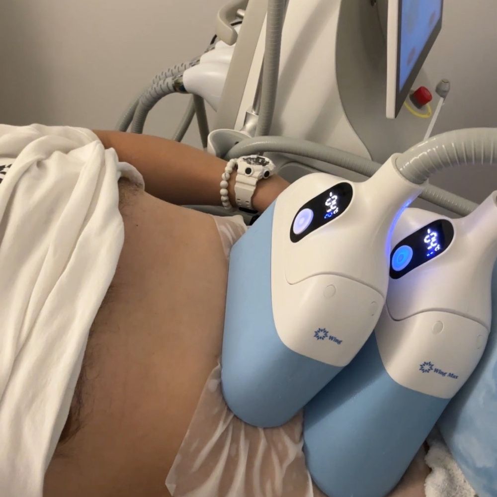 Ambition Medical Spa - The cryo freeze is working wonders - Medical Spas Near Me - Burlingame, California Ambition Medical Spa - The cryo freeze is working wonders - Medical Spas Near Me - Burlingame, California