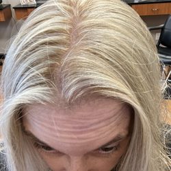 Inflammation and thinning already