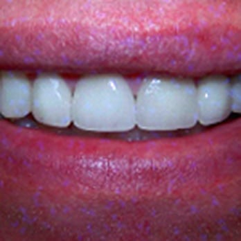 Jackson Dental - General Dentistry Near Me - Carrollton, Texas Jackson Dental - General Dentistry Near Me - Carrollton, Texas