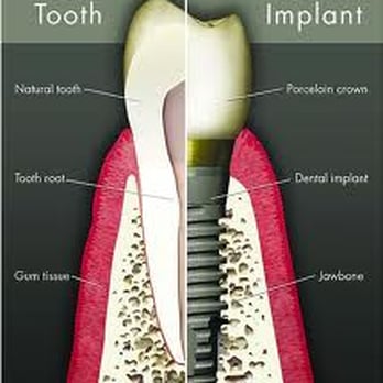 Robert L Cohen, DDS - General Dentistry Near Me - Sherman Oaks, California