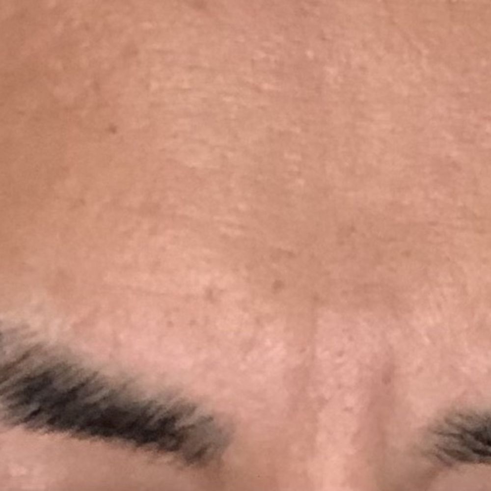 Half of right eyebrow chopped.