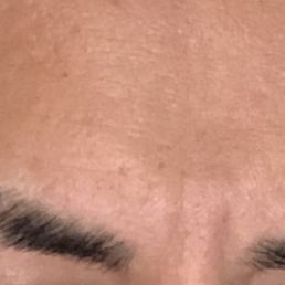 Half of right eyebrow chopped.