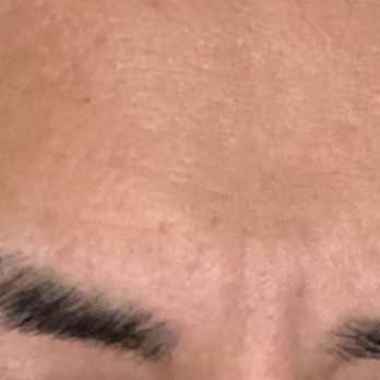 Eyebrow Plus  - Half of right eyebrow chopped. - Eyebrow Services Near Me - San Francisco, California