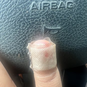 Modo Nail Bar - Injuries I've sustained from this business - A finger with a bandage and bloodstains is placed on a textured steering wheel of a vehicle, with the word 'AIRBAG' visible. - Skin Care Near Me - Laurel, Maryland