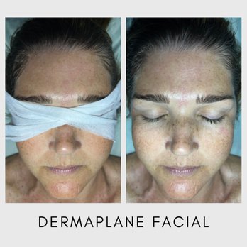 Nikki McNab Aesthetics - Before & After - Aestheticians Near Me - Orange Beach , Alabama Nikki McNab Aesthetics - Before & After - Aestheticians Near Me - Orange Beach , Alabama
