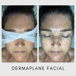 Nikki McNab Aesthetics - Before & After