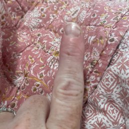 My healed up index finger My healed up index finger