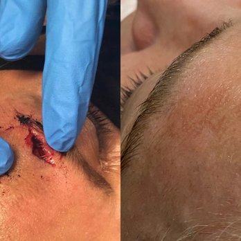 Kingwood Urgent Care - Injury before and after. - Urgent Care Near Me - Humble, Texas Kingwood Urgent Care - Injury before and after. - Urgent Care Near Me - Humble, Texas