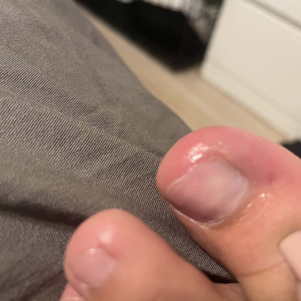 Dalila’s Nails & Spa - Toe got infected the next day pus came out - Nail Salons Near Me - Riverside, California Dalila’s Nails & Spa - Toe got infected the next day pus came out - Nail Salons Near Me - Riverside, California
