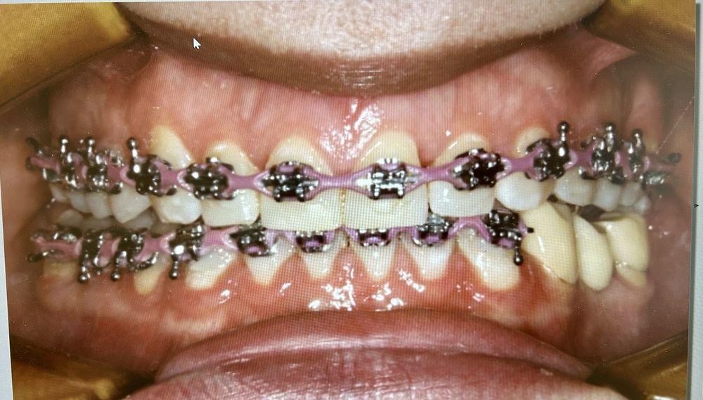 SMILELIFE ORTHODONTICS OF EL PASO FAR EAST Updated October 2024 14