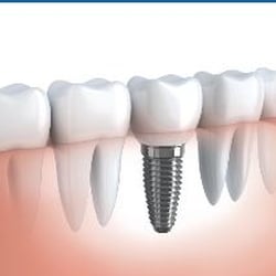 Dean Dental Associates