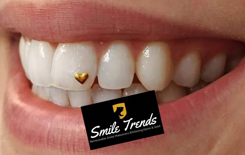 SMILE TRENDS Updated June 2024 19 Photos Indianapolis, Indiana Teeth Whitening Phone