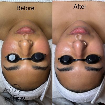 Idan Med Spa by null